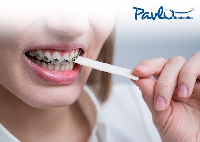 chewing gum can be detrimental for patients with braces.